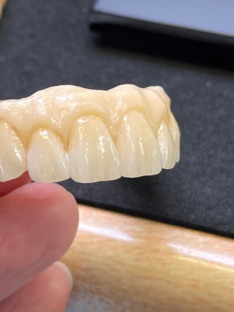 prothèse dent