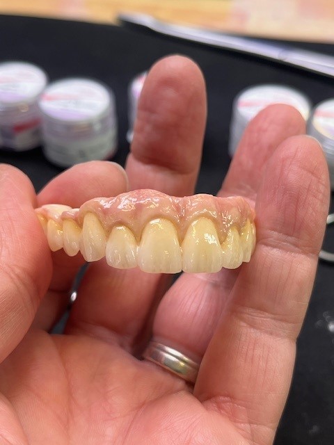 dents du haut peintes labo duffar