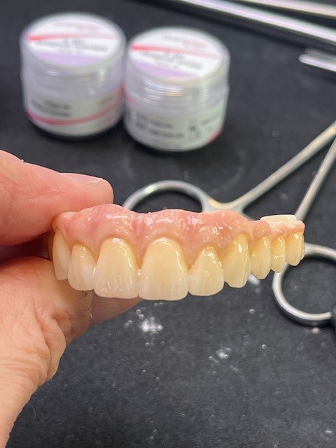 exemple de dents céramiques